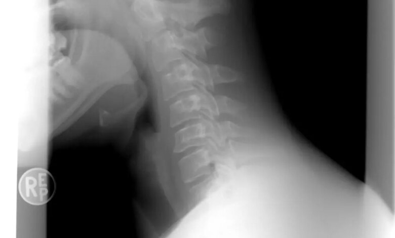 Ursachen, Lösungen und wirksame Tipps 1 Douleurs cervicales
