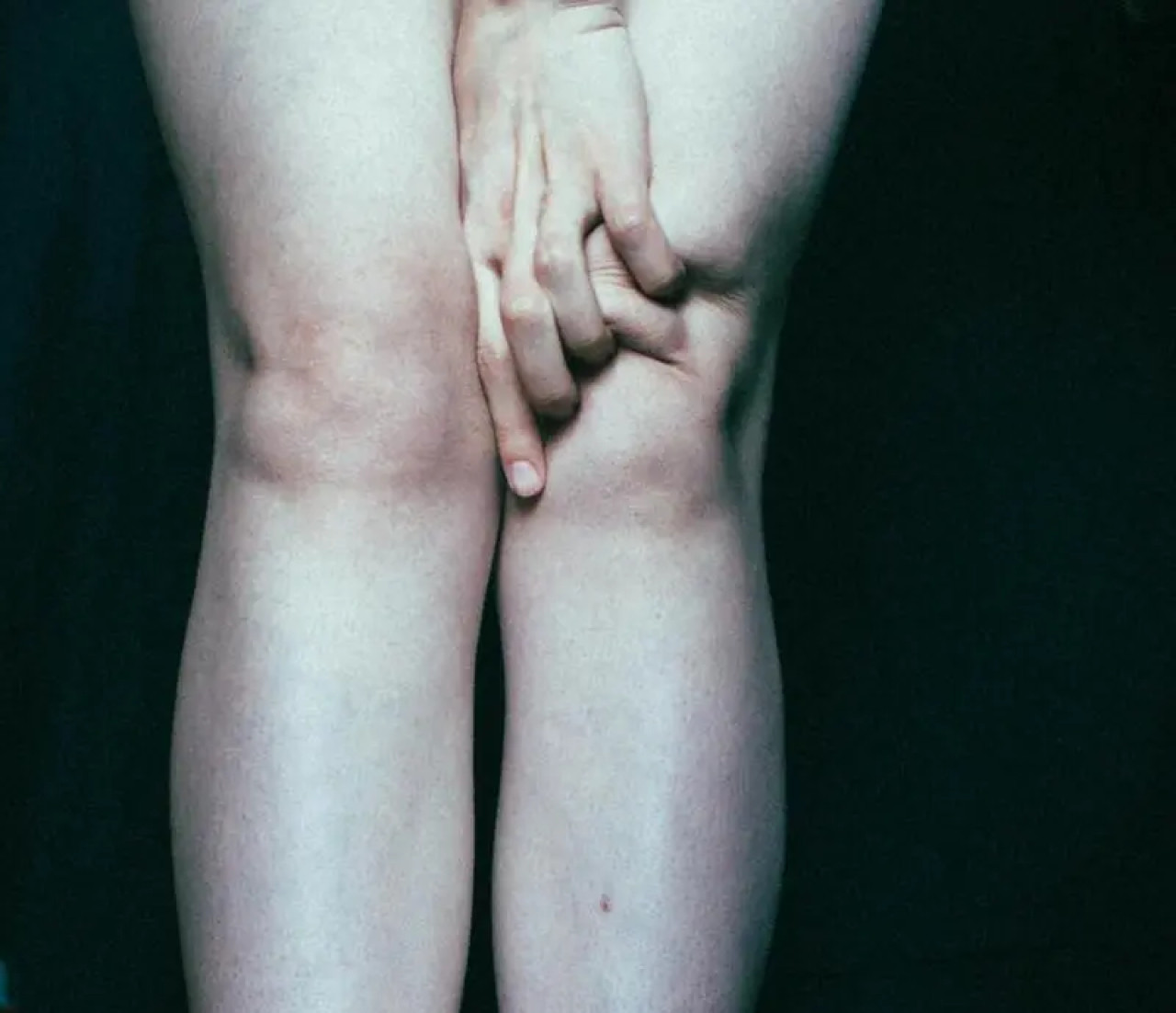 Kreuzbandriss im knie: symptome und schnelle erkennung 1 Kreuzbandriss im knie: symptome und schnelle erkennung